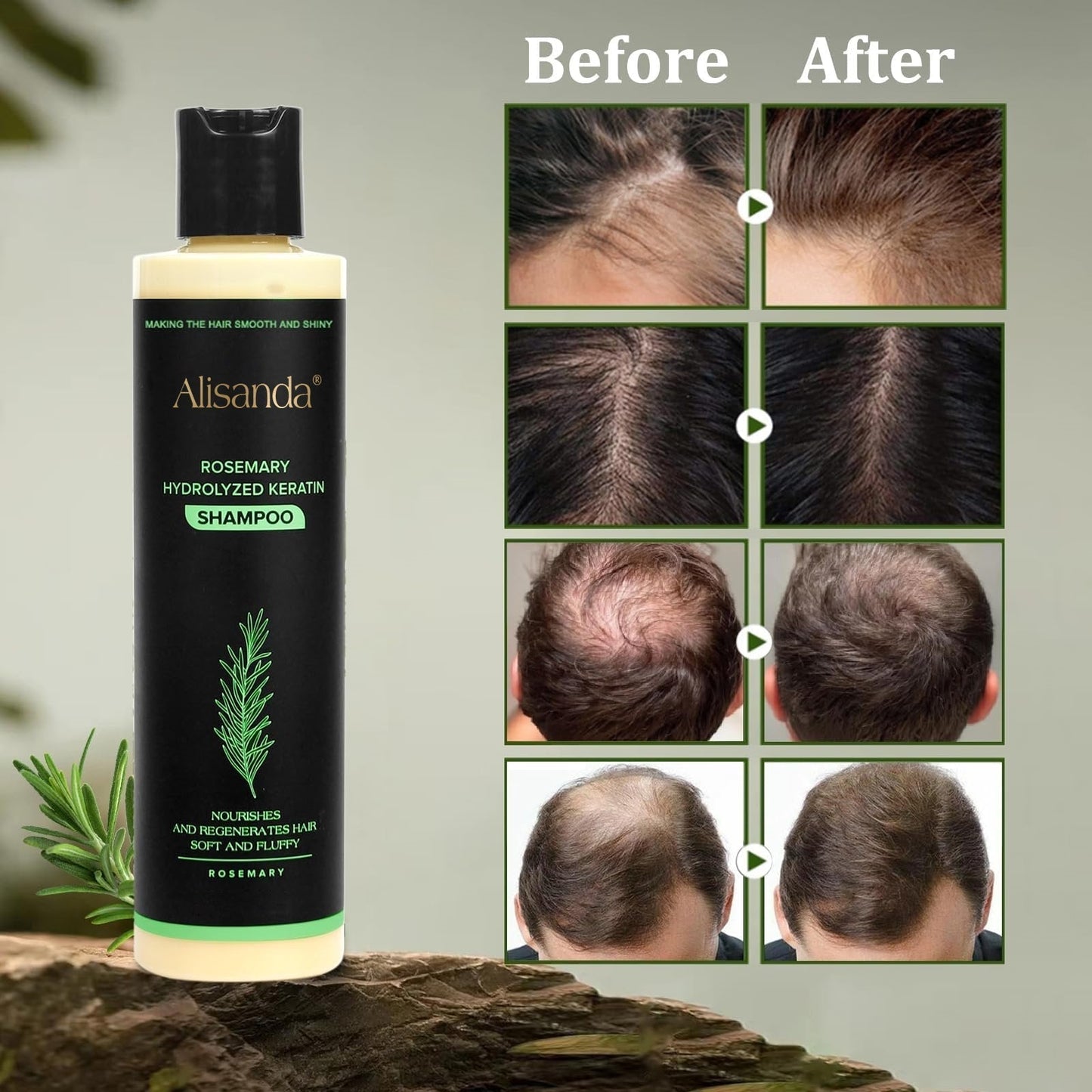 đ„LAST DAY 50% OFF - AlisandaÂź Organic Rosemary Hair Growth Shampoo