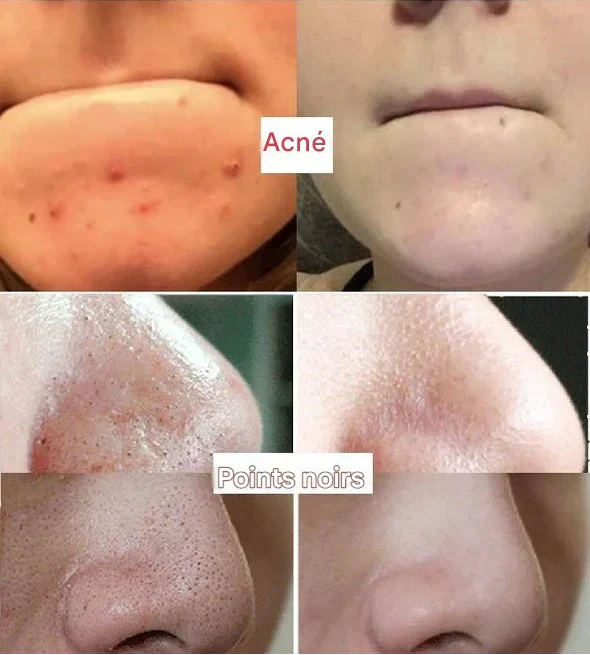 Diystar™ Masque Nettoyant en Profondeur au Thé Vert 100% Naturel