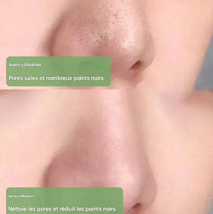 Diystar™ Masque Nettoyant en Profondeur au Thé Vert 100% Naturel