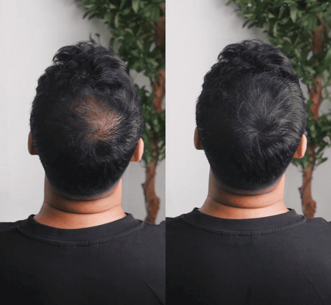 GROWY™ Poudre capillaire - Achetez-en 1 et recevez-en 2