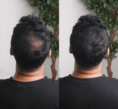 GROWY™ Poudre capillaire - Achetez-en 1 et recevez-en 2