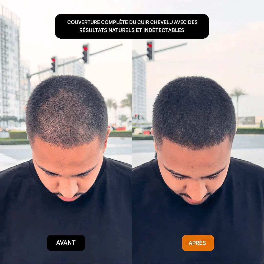 GROWY™ Poudre capillaire - Achetez-en 1 et recevez-en 2