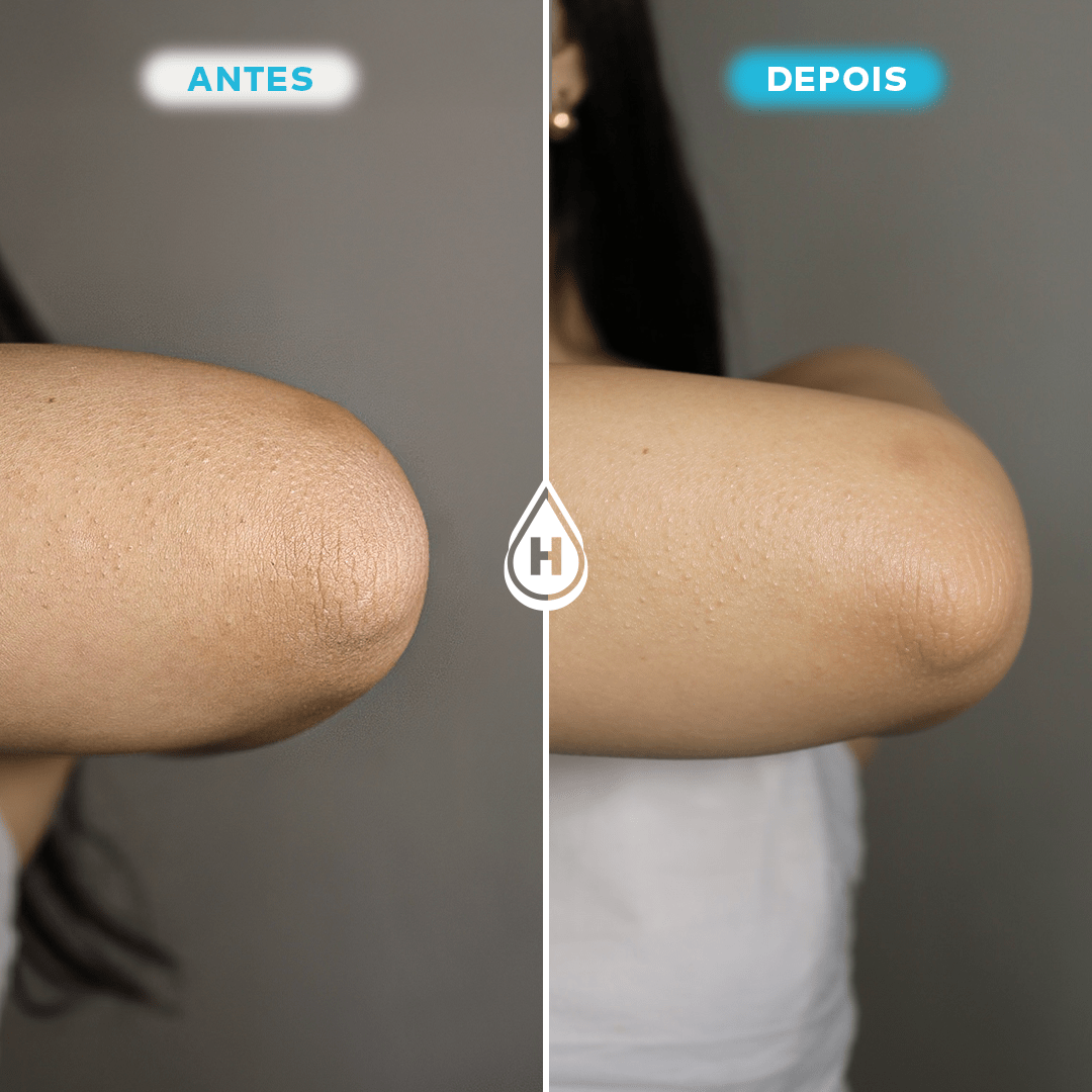 Kit 2 Loção Hidratante Corporal 200ml