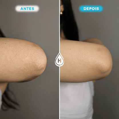 Kit 2 Loção Hidratante Corporal 200ml